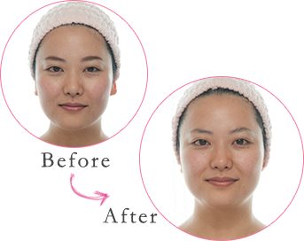Before&After